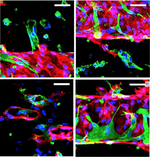 Patterned human microvascular grafts enable rapid vascularization and increase perfusion in infarcted rat hearts