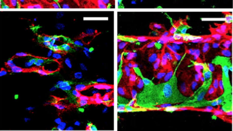 Patterned human microvascular grafts enable rapid vascularization and increase perfusion in infarcted rat hearts