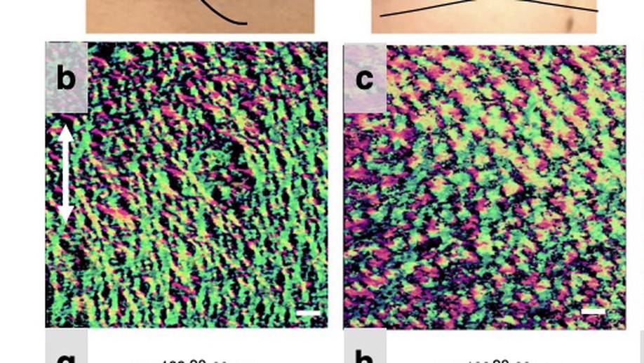 Polarization sensitive optical coherence tomography with single input for imaging depth-resolved collagen organizations