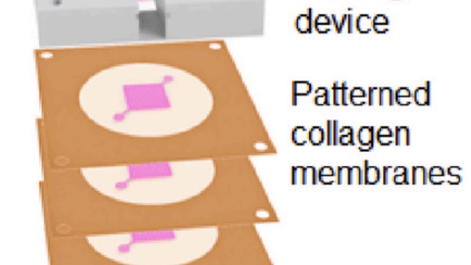 Stacking thick perfusable human microvascular grafts enables dense vascularity and rapid integration into infarcted rat hearts